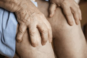 Gelenkgesundheit & Arthrose
