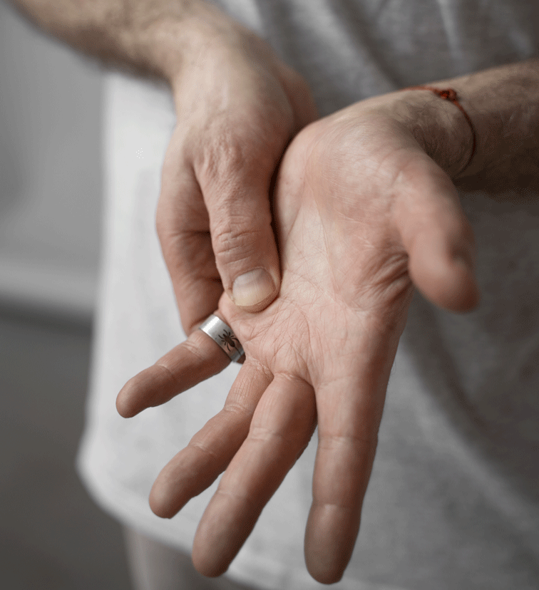 Arten von Artrhose: Fingergelenk-Arthrose
